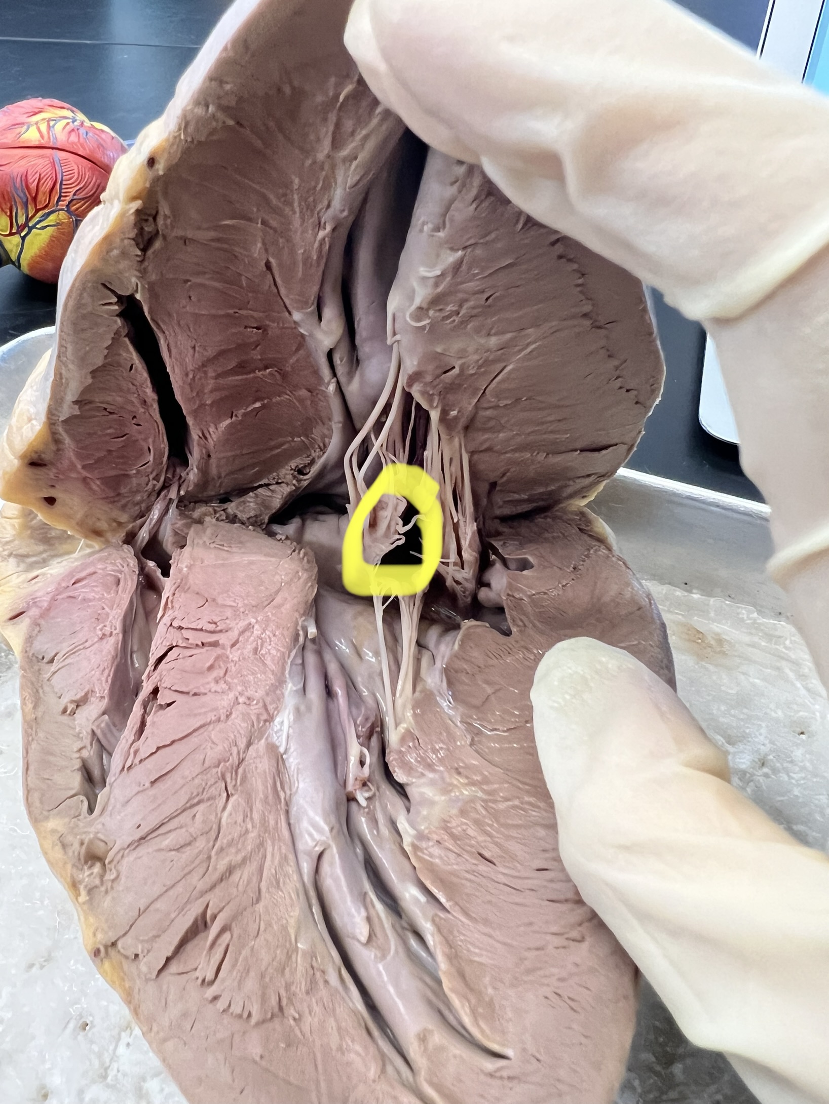 Name the heart structure.