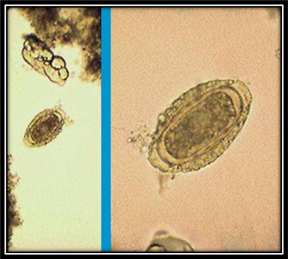 <p>canine right kidney canine giant kidney worm largest parasitic nematode to affect domestic animals wanders to peritoneal cavity</p>