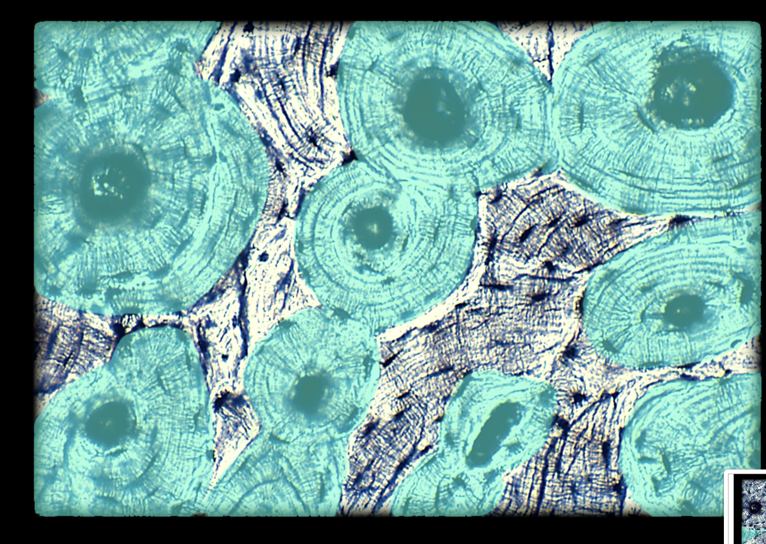 <p>Osteon</p>