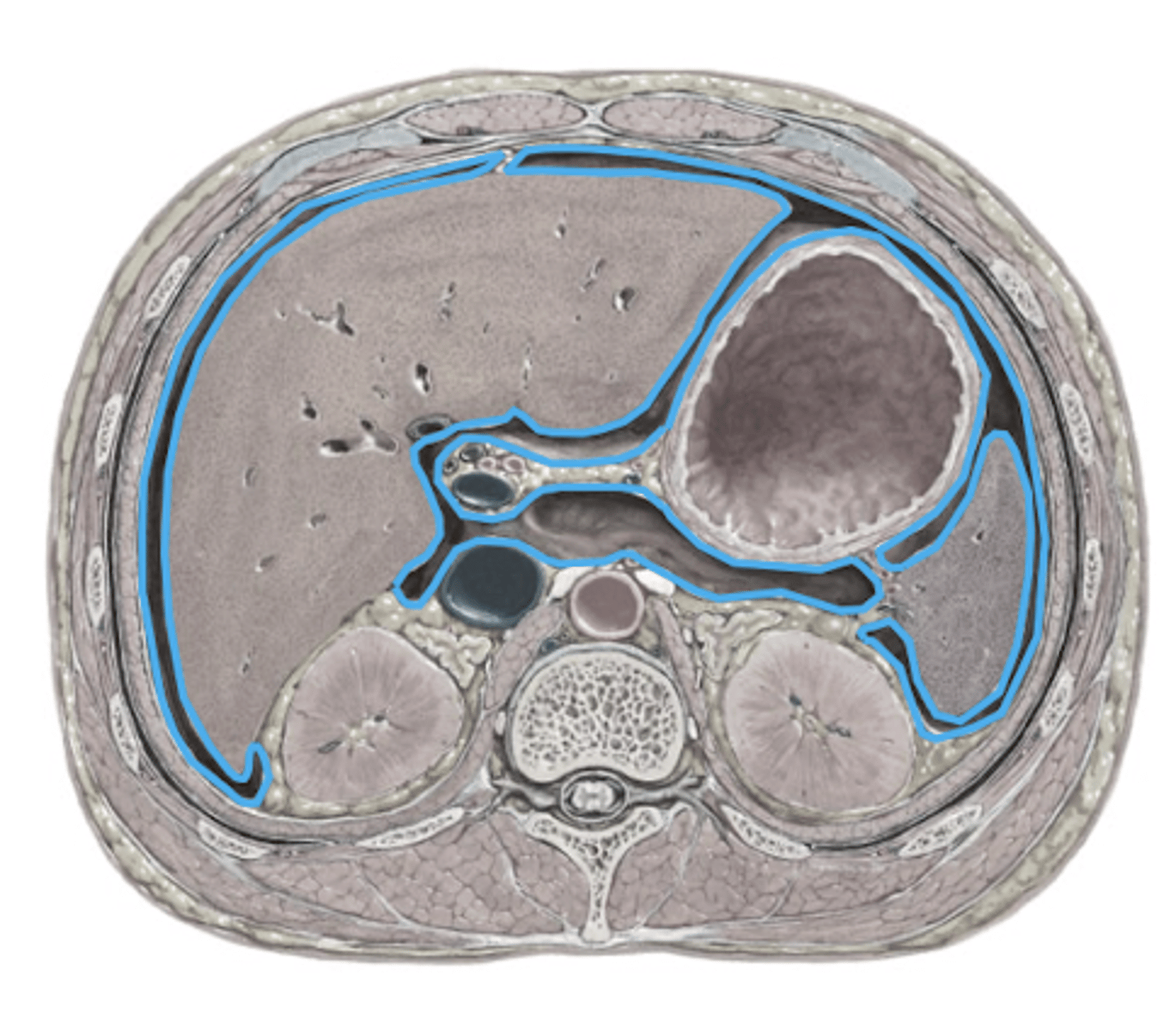 <p>Larges serous membrane in body (makes serous fluid)</p><p>Lines:</p><p>-walls of abdominal cavity</p><p>-walls of abdominal organs</p><p>-blood vessels and nerves traveling between</p>