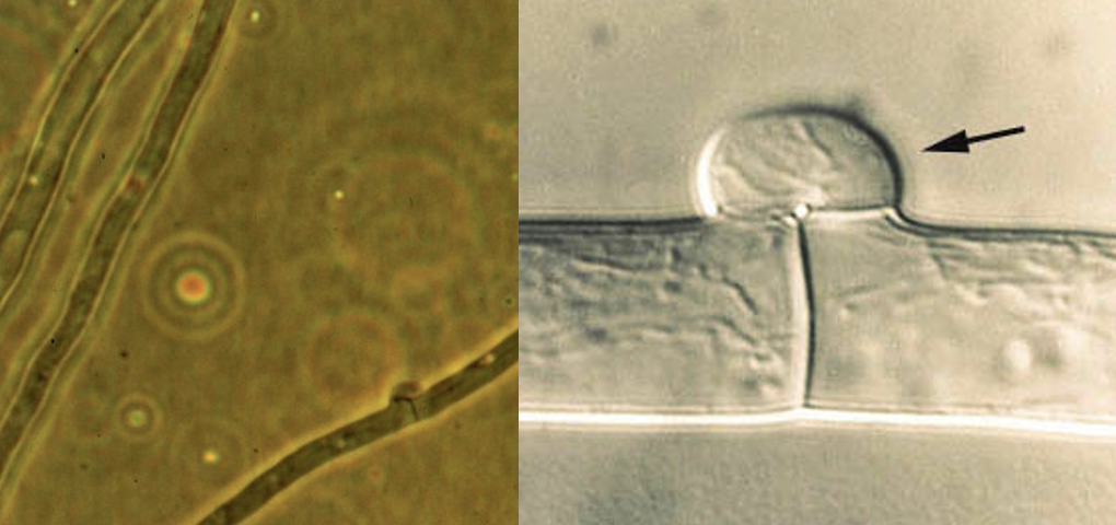 <p>Basidiomycetes (degraders)specialized hyphal cross walls (septa) in higher fungi that facilitate nuclear separation during cell division. Characteristic of BR and WR</p>