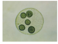 <p>What is the genus of this organism?</p><p>A. Volvox</p><p>B. Spirogyra</p><p>C. Physarum</p><p>D. Euglena</p>