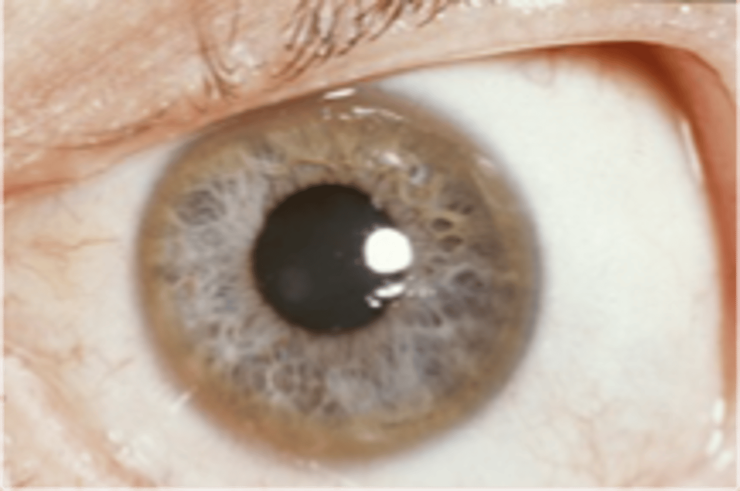 <p>name the abnormality</p>