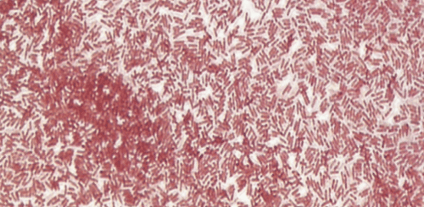 <p>gram (-) → stains red</p>
