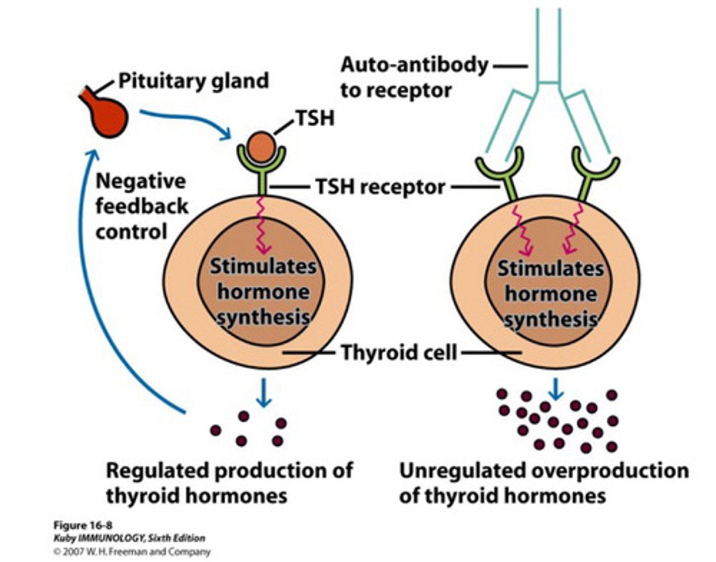 <p>What disease is represented in this image on the right?</p>