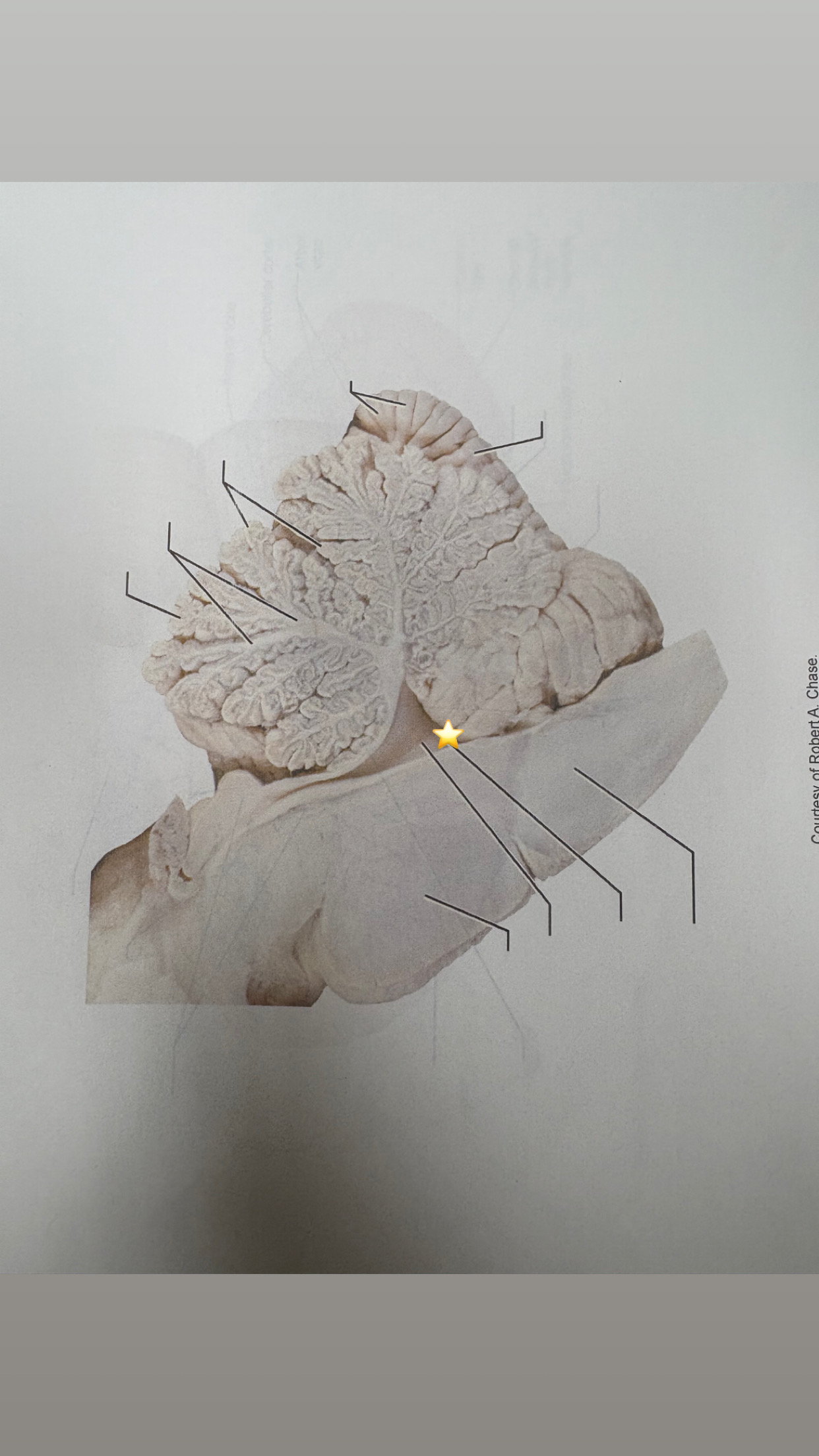 <p>name the starred structure</p>