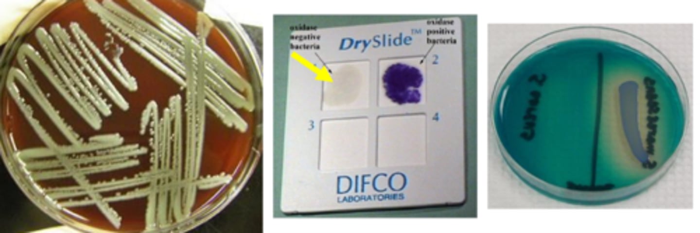 <p>Yellow pigment</p><p>Grow on blood, chocolate, MacConkey</p><p>Odor - grandma's basement</p>