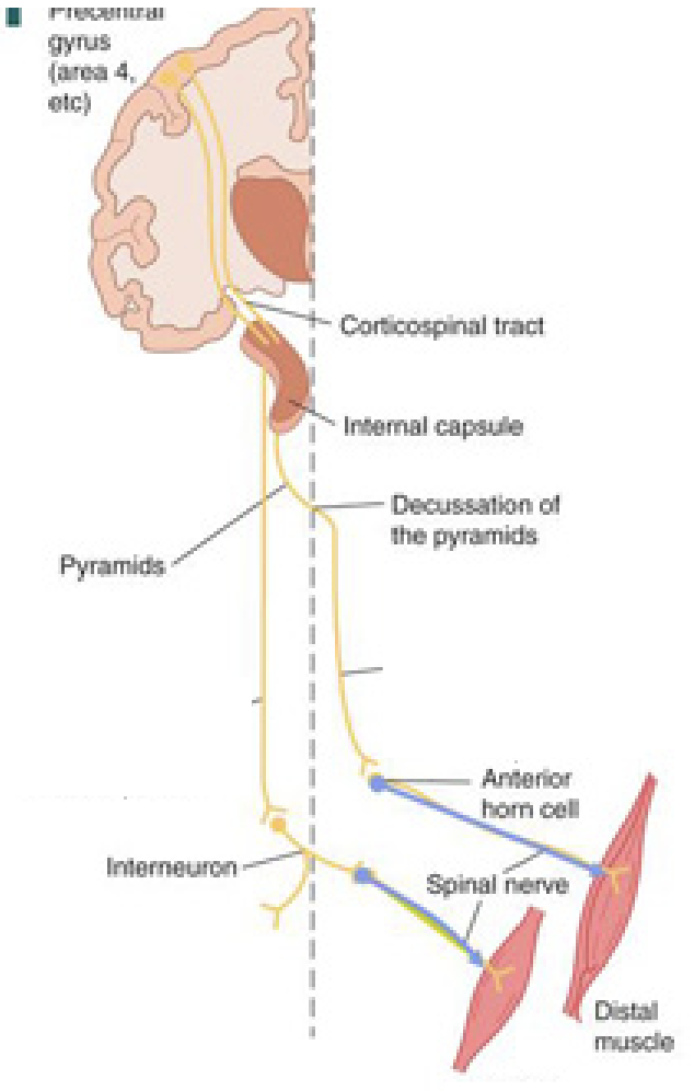 <p>Types of Paralysis (2)</p>