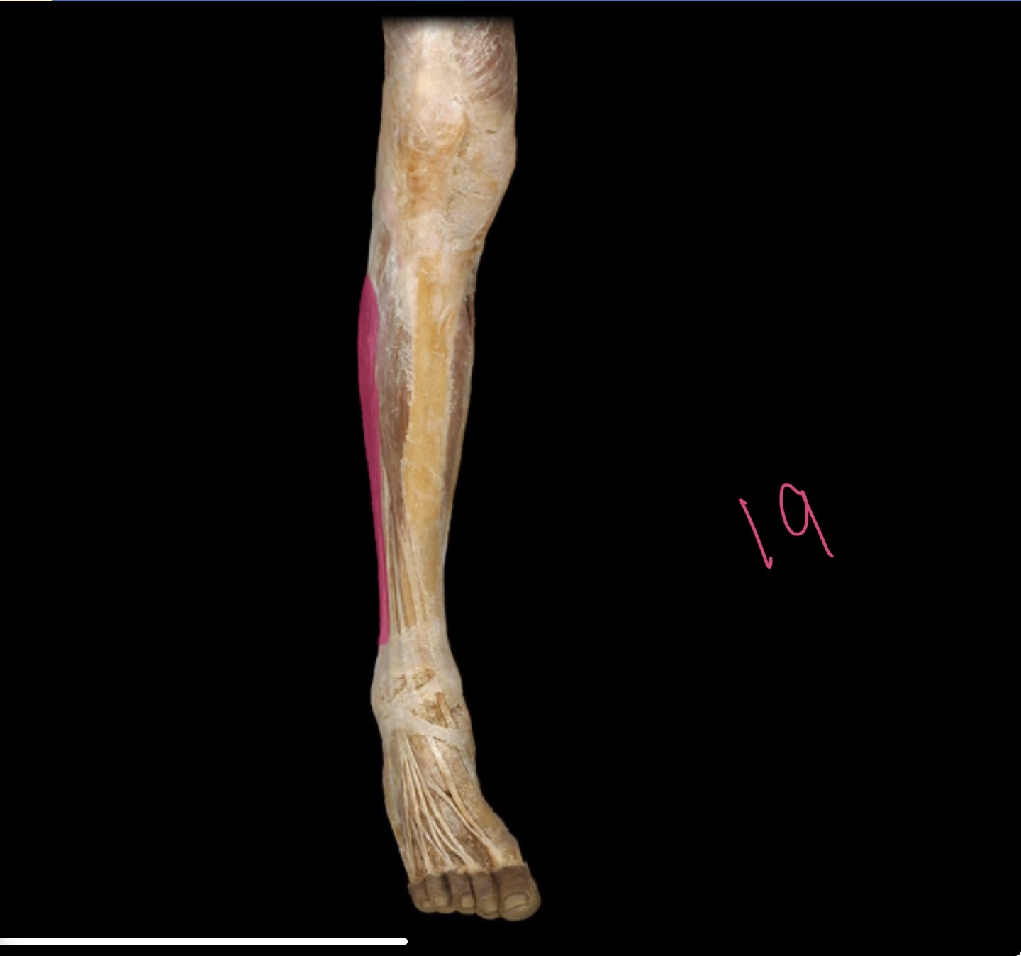 <p>Fibularis longus and brevis mm</p>