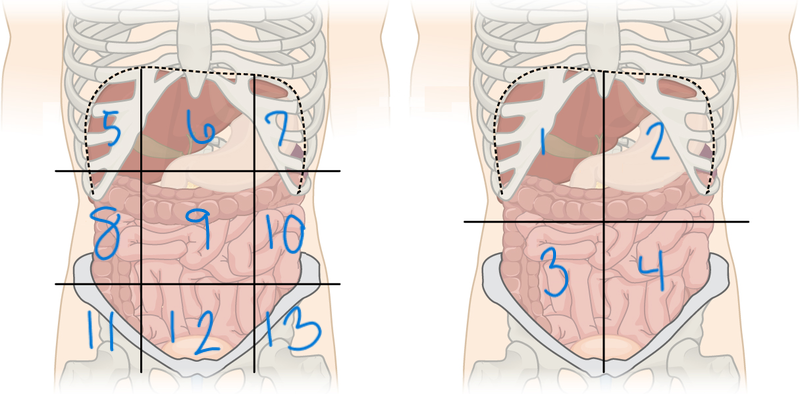 <p>Left Lower Quadrant (LLQ)</p>