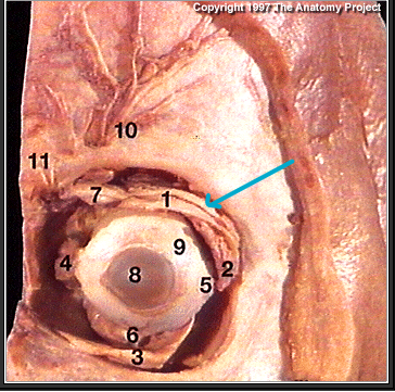 <p>What muscle?(#1)</p>