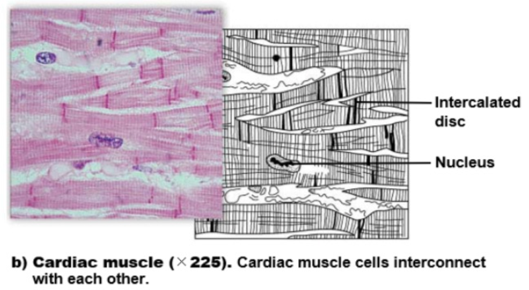 <p><span style="color: #83cd47"><strong>cardiac muscle </strong></span></p>