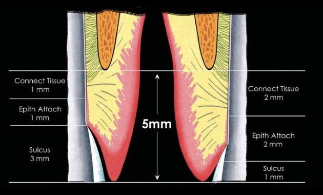 <p>Where is cord actually packed?</p>