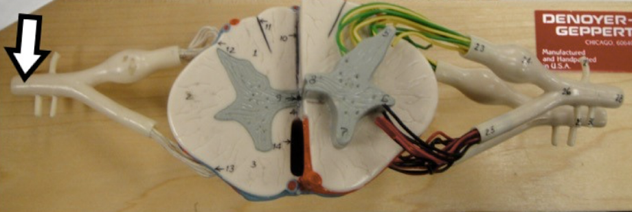 <p>identify this structure</p>