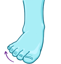 the sole away from median plane