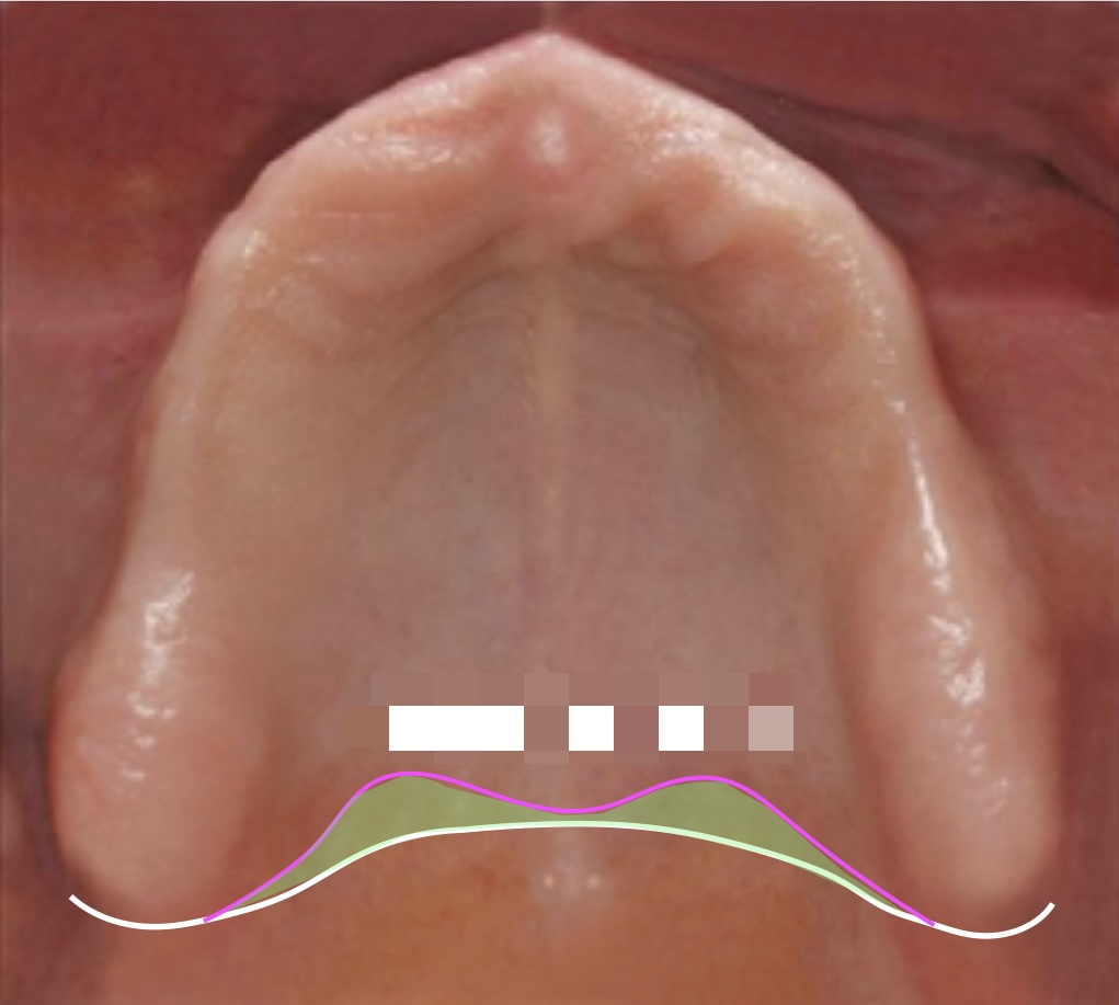 <p>what structure is demonstrated by the white line?</p>
