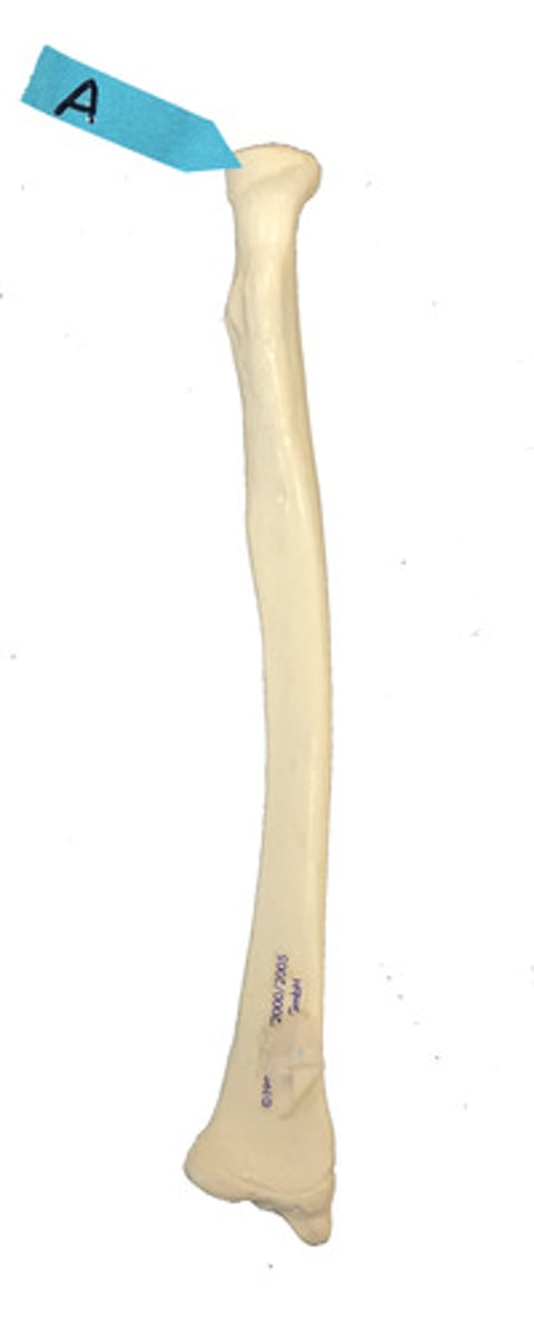 <p>Identify this bone marking.</p>