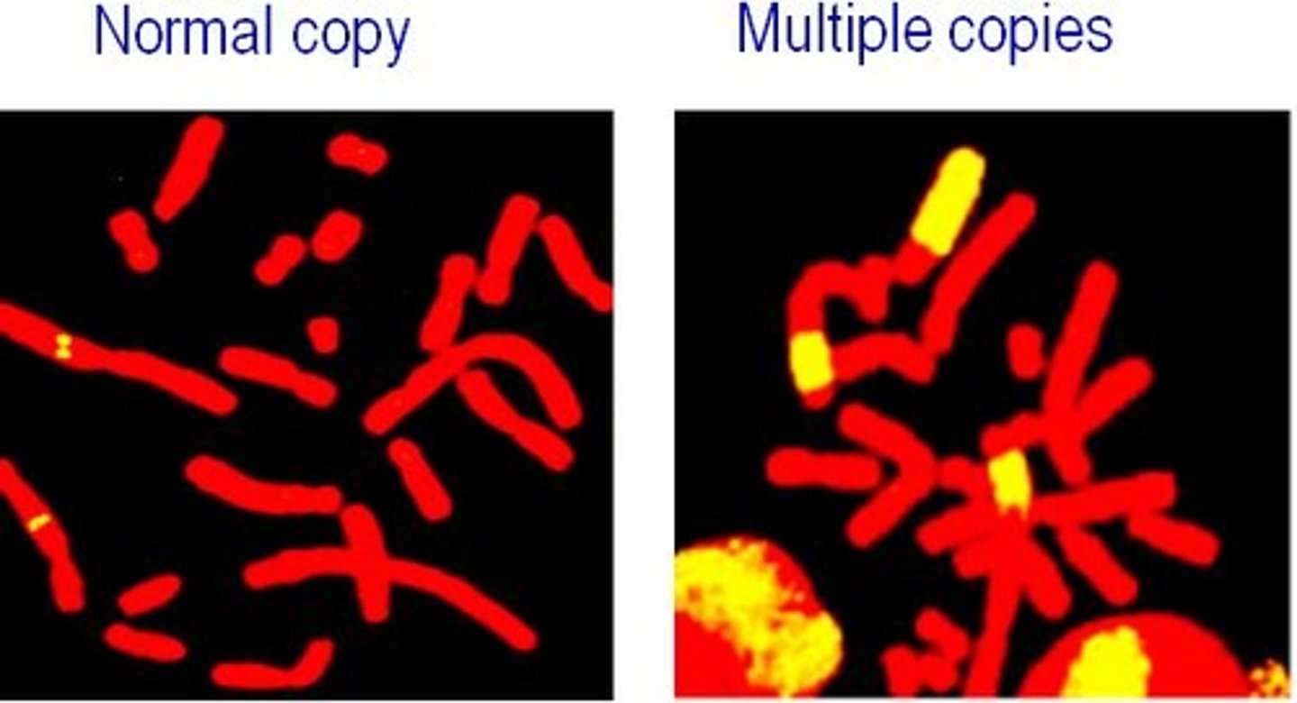 <p>result of repeated duplication of a region of a chromosome</p><p>- instead of 2 copies of a gene there are tens of hundreds of copies present.</p><p>- seen in neuroblastoma</p>