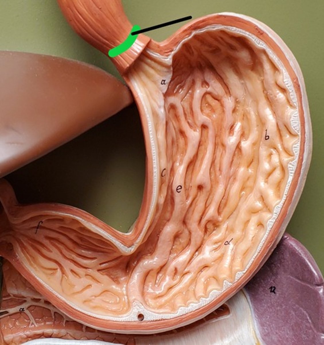 <p>ID the Muscle</p>