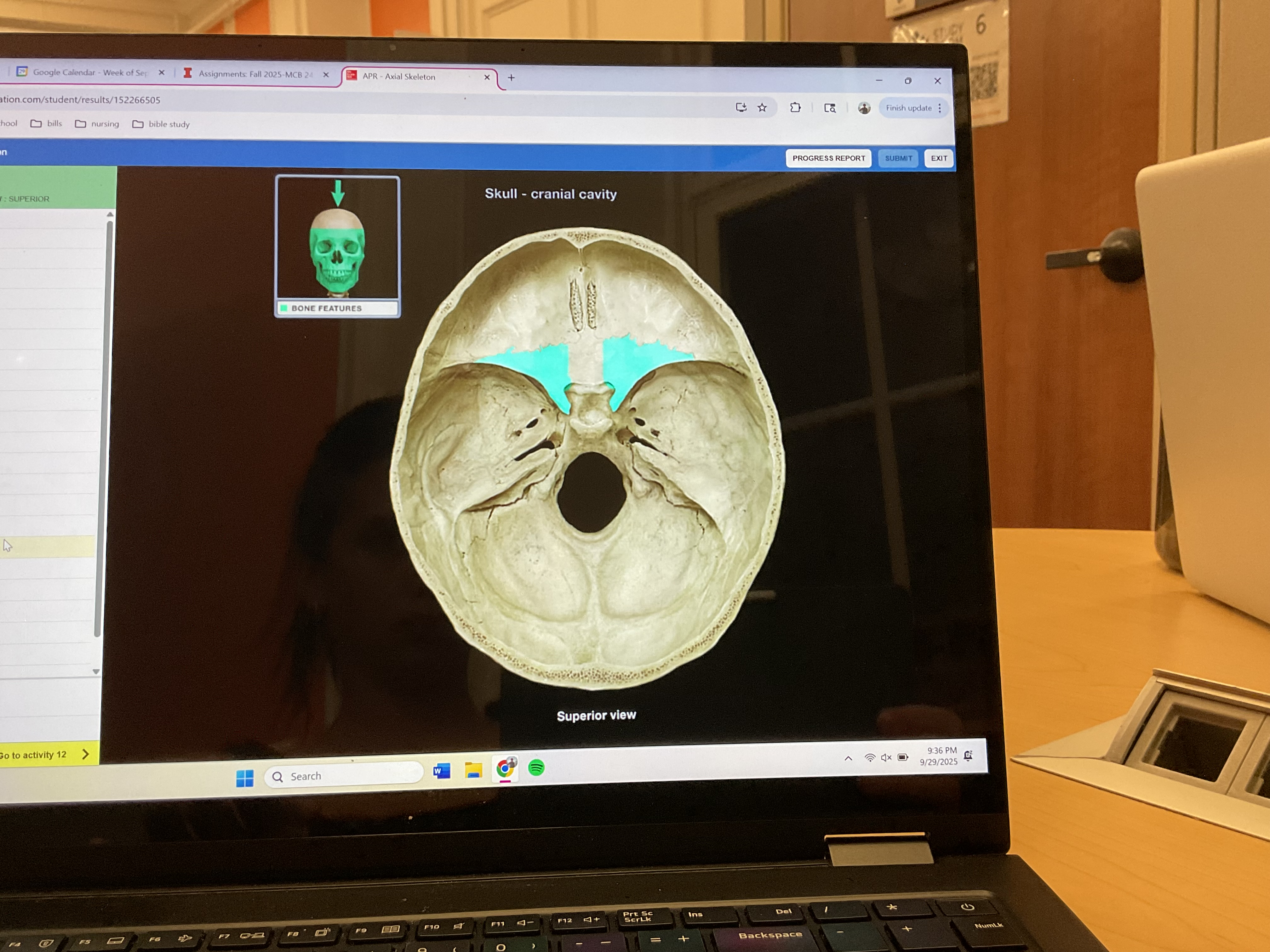 <p>Lesser wing of sphenoid bone </p>