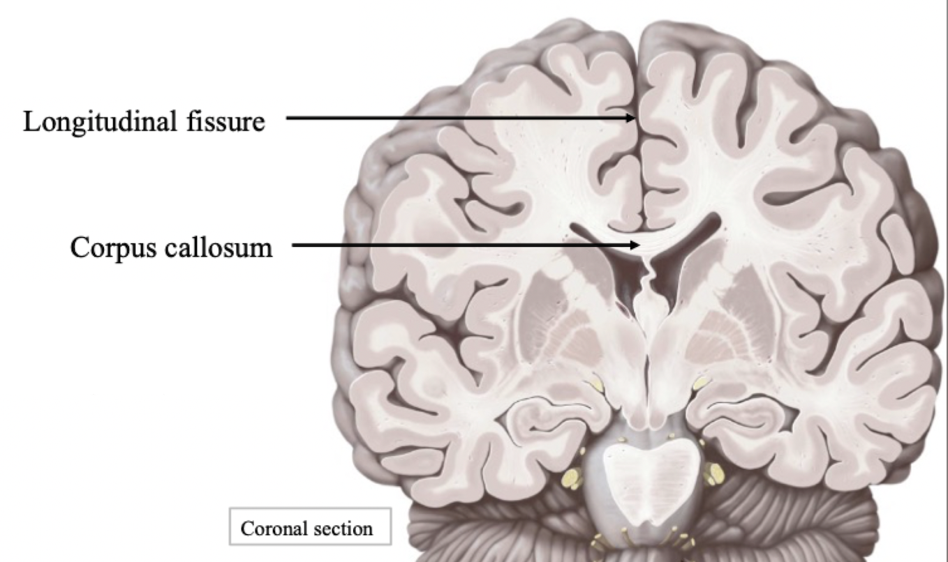 <p><u>Longitudinal fissure</u></p><ul><li><p>Separates right and left cerebral hemispheres</p></li><li><p>Travels from anterior to posterior</p></li></ul><p><u>Corpus callosum</u></p><ul><li><p>Connects right and left cerebral hemispheres</p></li><li><p>Comprised of white matter</p></li><li><p>﻿﻿Communication bridge - how left and right hemispheres communicate</p></li></ul>