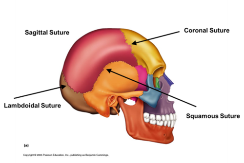 <p>coronal, sagittal, lambdoid, squamous</p>