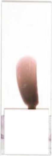 <p>What is this blood film appearance, and what is the cause/solution?</p>
