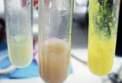 <p>What are the reagents in the 3rd test tube (rightmost)?</p>