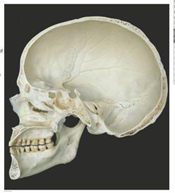 <p>Label the bones</p>