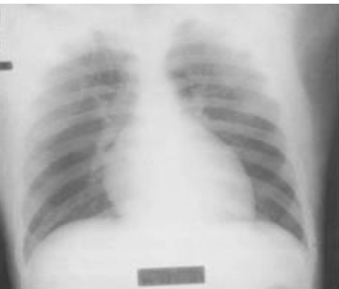 <p>diagnosis</p>