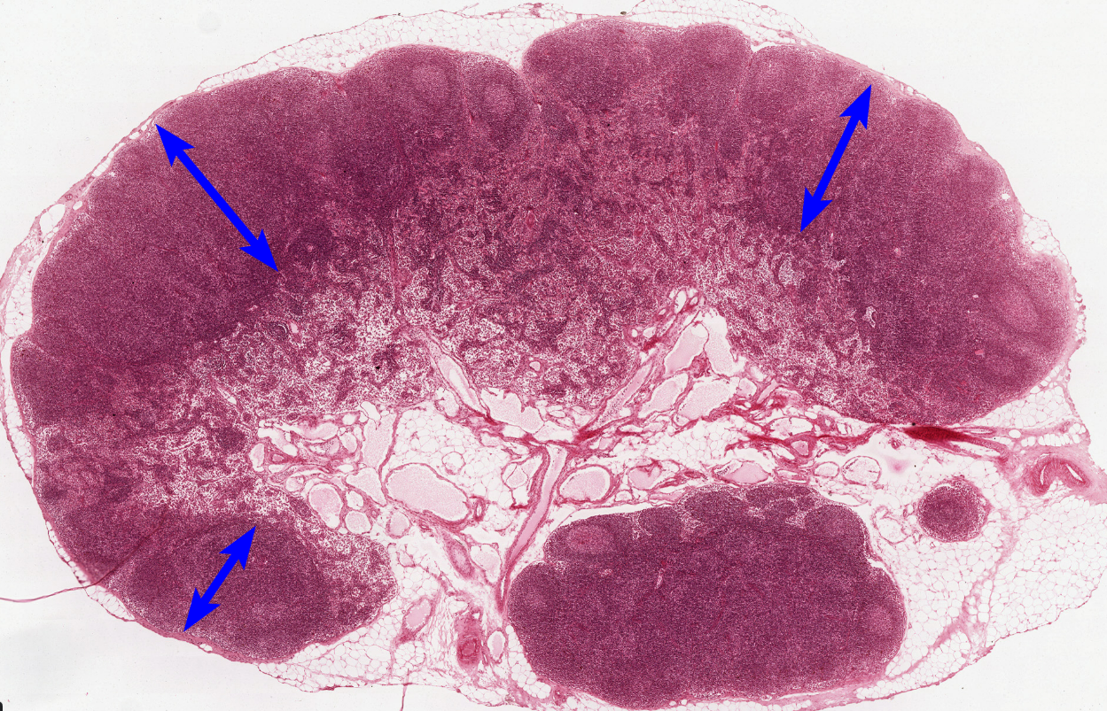 <p>region with<strong> lymphatic nodule</strong></p>