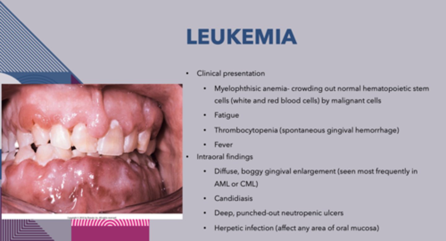 <p>Leukemia</p>