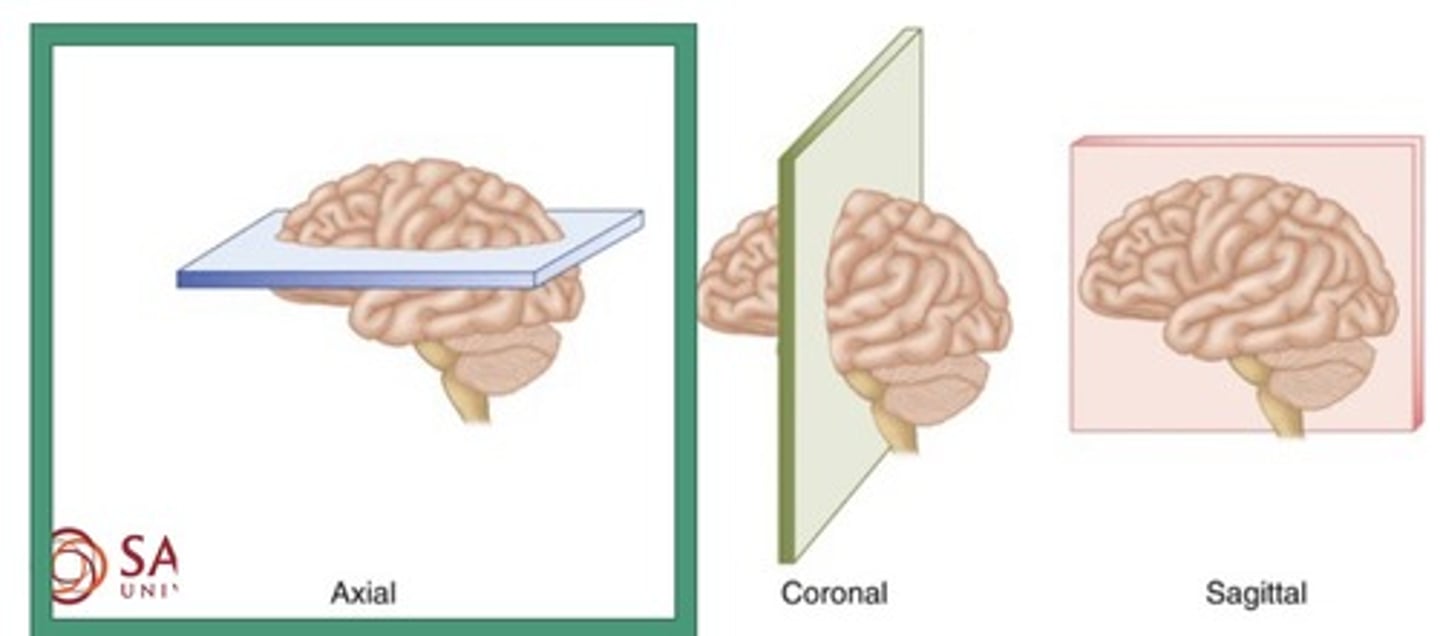 <p>1. Coronal</p><p>2. Sagittal</p><p>3. Axial</p>