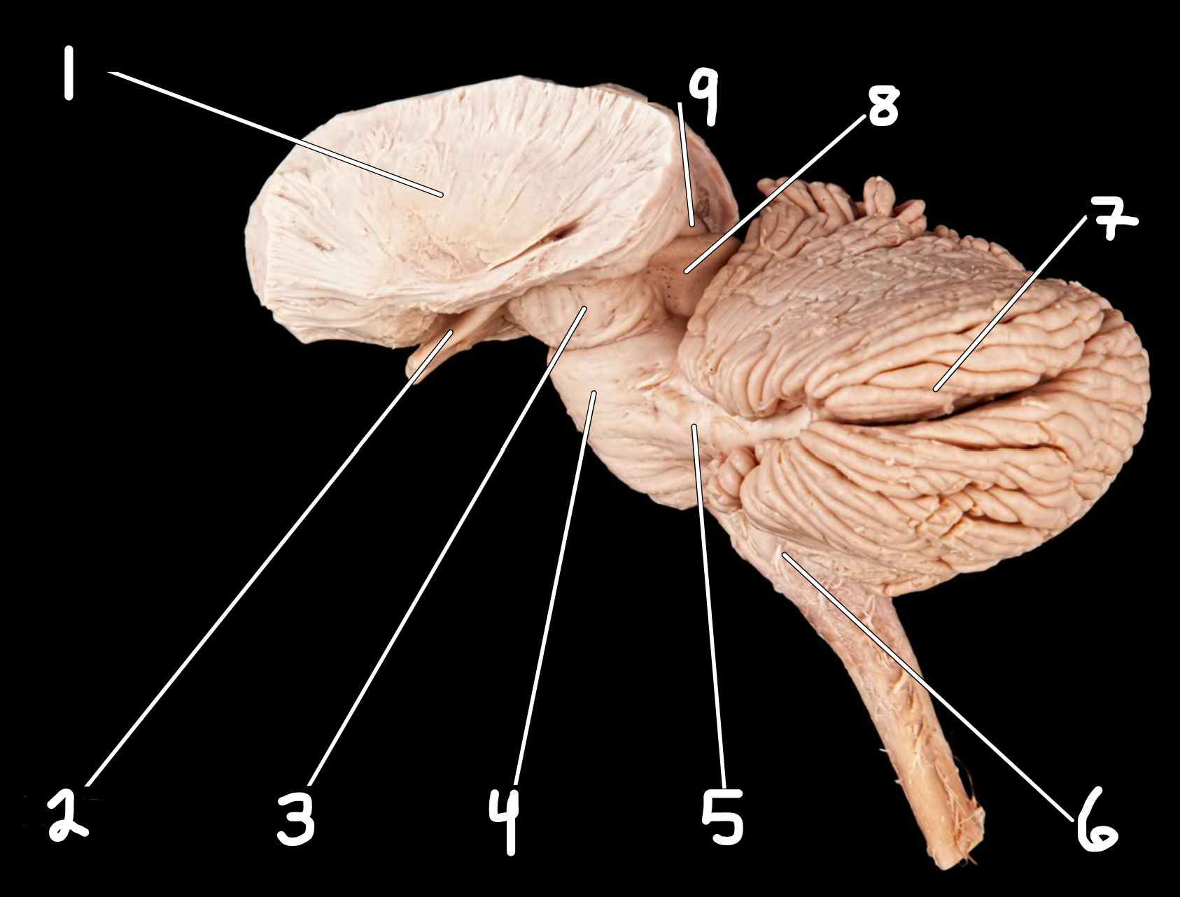 <p>Midbrain and cerebellum: lateral view </p>