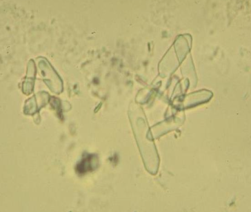 <p>True or False? Calcium oxalate monohydrate crystalluria indicates renal disease.</p>