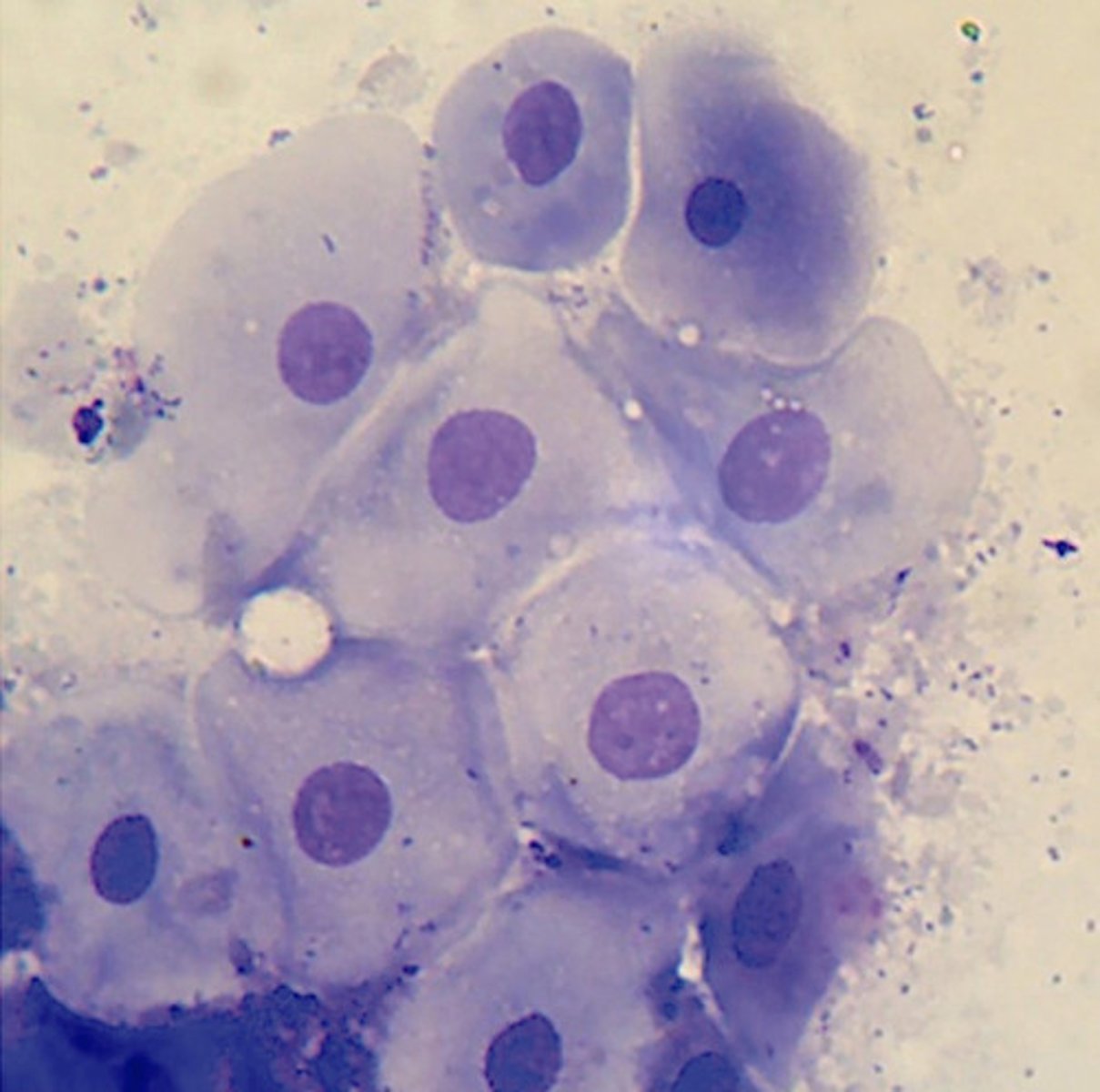 <p>Large intermediate epithelial cell</p>