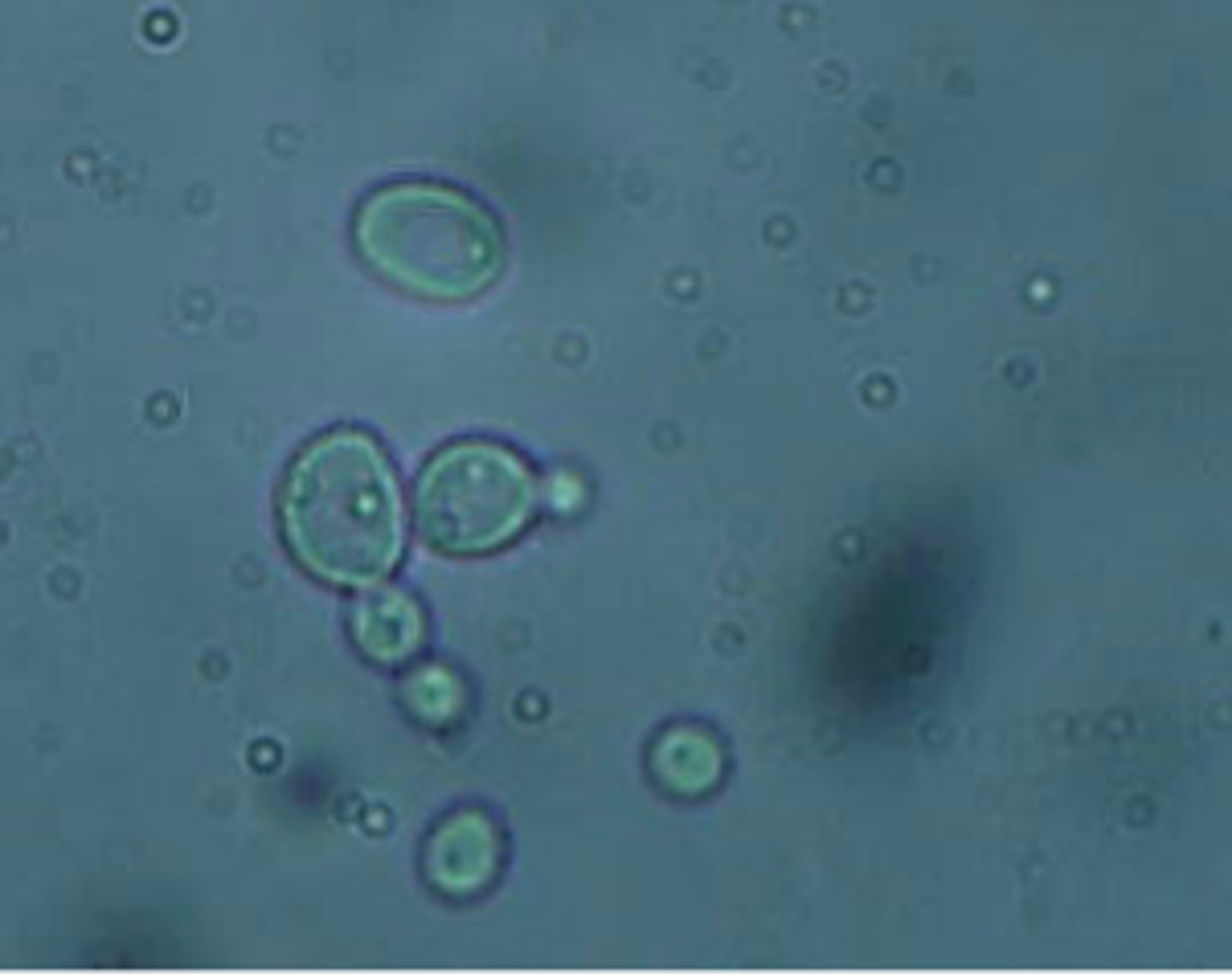 <p>b. Saccharomyces cerevisiae</p>