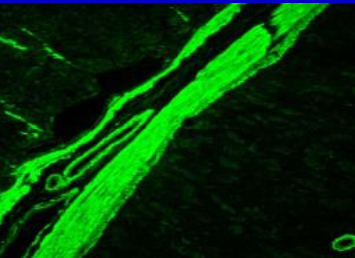 <p>Anti-smooth muscle </p>