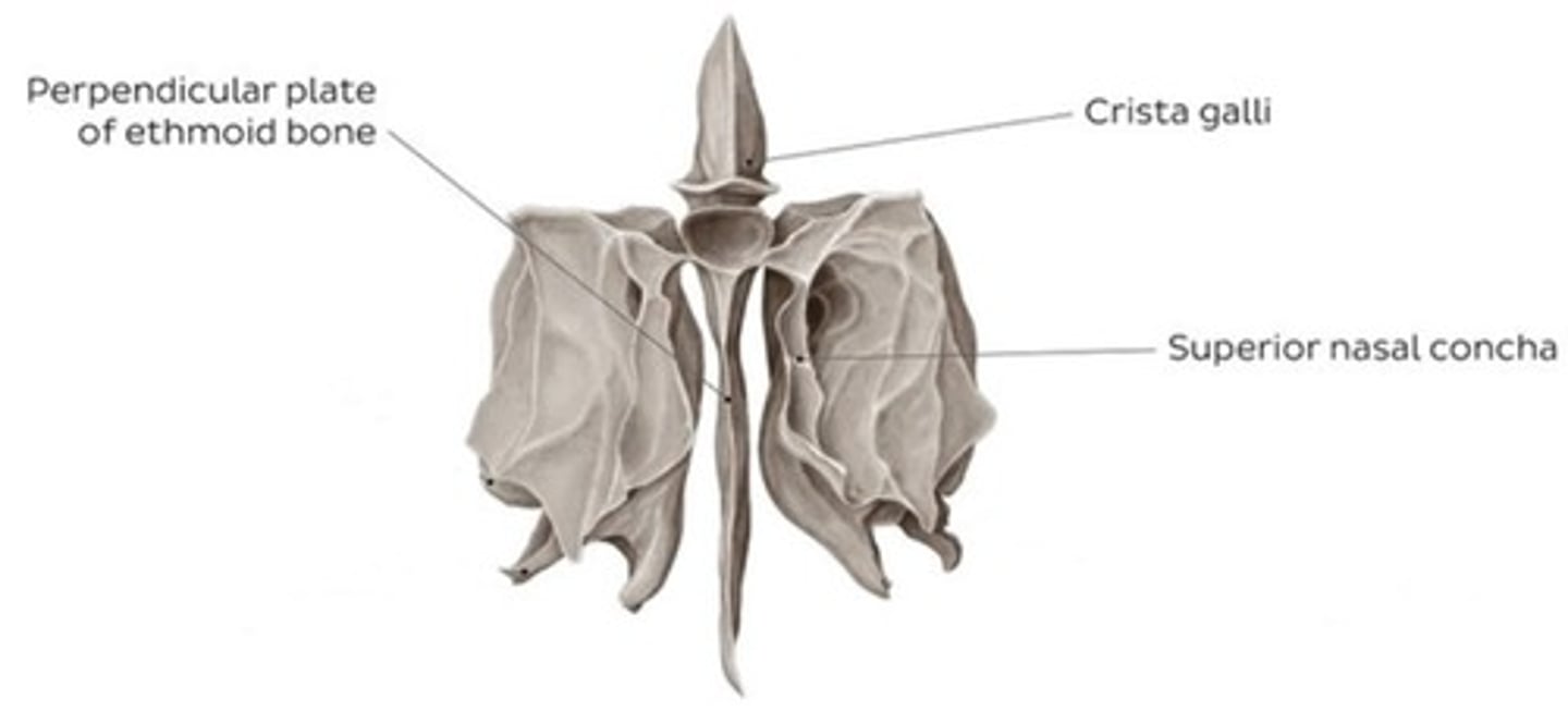 <p>Frontal bone, Occipital bone, Sphenoid bone, Ethmoid bone</p>