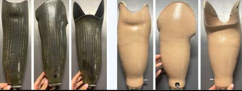 <ul><li><p><span style="color: red;"><strong><u>Equal distribution of loads </u></strong></span>across the entire surface of the residual limb</p></li><li><p>Improved Suspension</p></li><li><p>Decreased shear on the residual limb</p></li></ul><p></p>