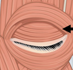 <ul><li><p>Muscle of facial </p></li><li><p>Muscle closes the eye</p></li></ul><p></p>