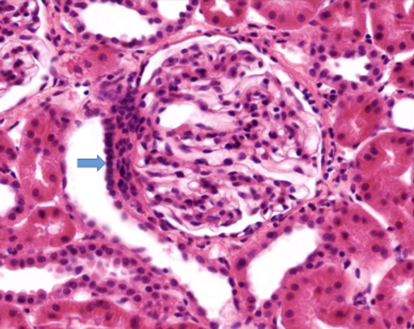 <p>Identify the nuclei on the distal convoluted tubule</p>