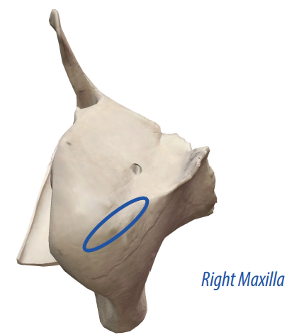 <p>A slit in the bone that usually houses nerves and blood vessels.</p>