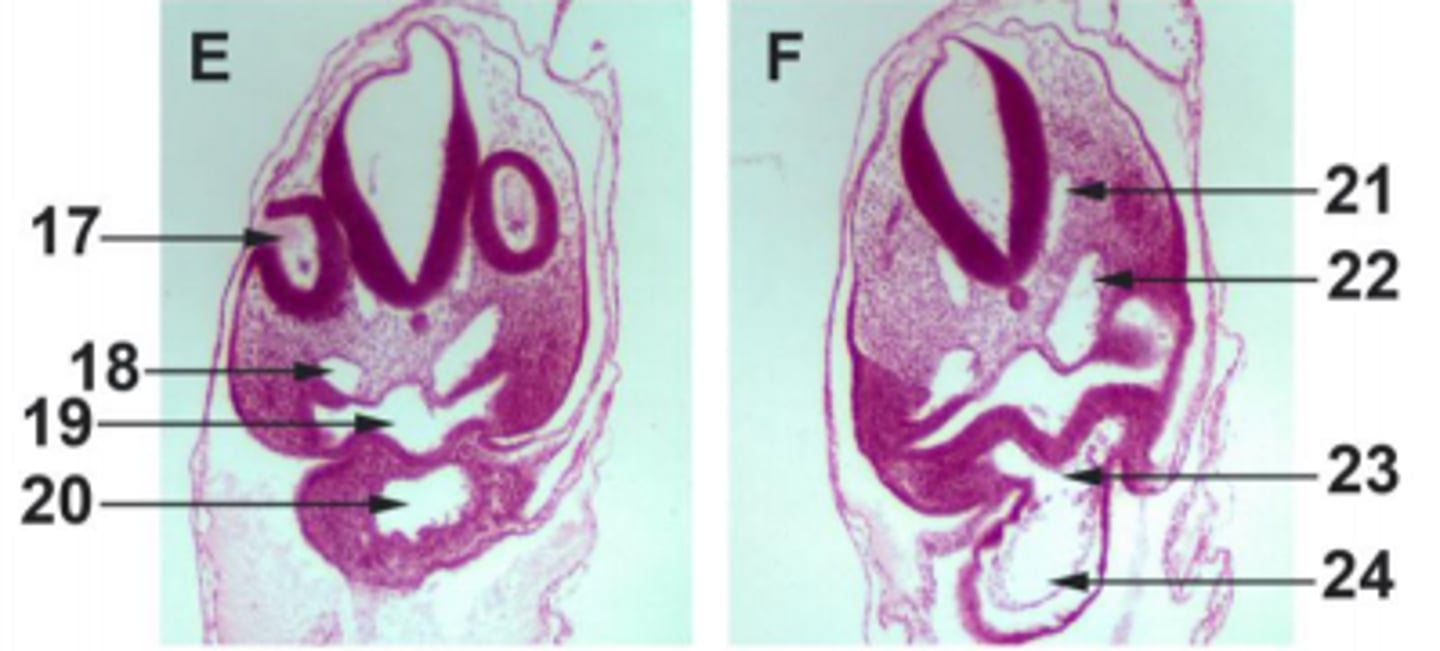 <p>#24</p><p>mesoderm</p>