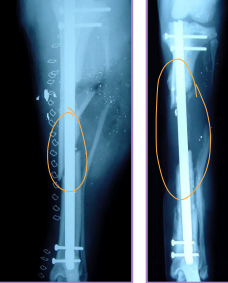 <ul><li><p>IV Radioactive substance (isotope)</p></li><li><p>Localization of lameness</p></li><li><p>ID avascular bone </p></li></ul><p></p>