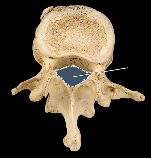 <p>What part of the vertebra is highlighted?</p><p>What type of vertebra is this (which region is this vertebra from)?</p><p>(Superior view).</p>
