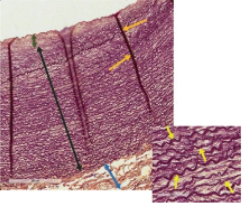 <p>what is this (wrinkles)</p>