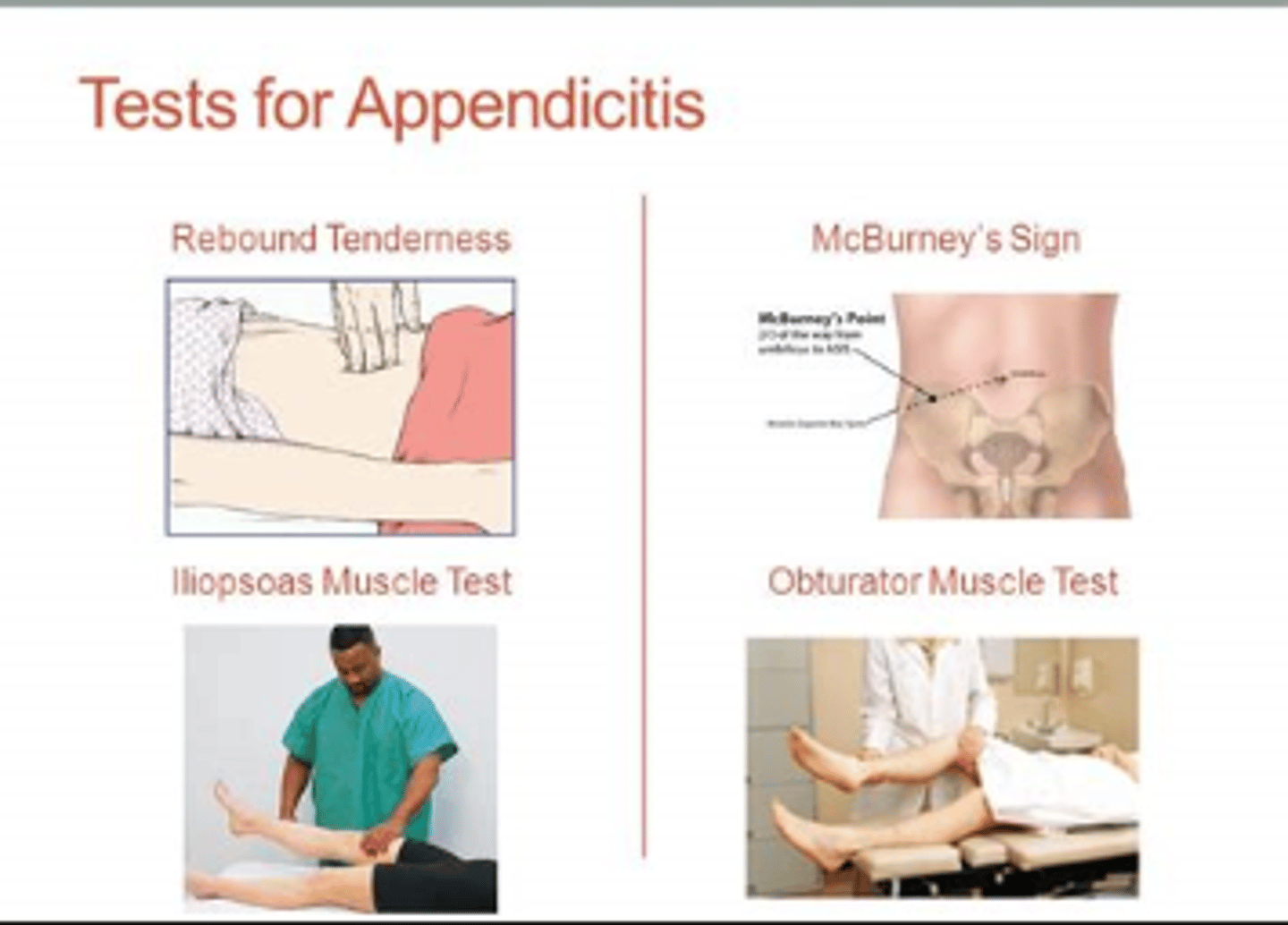 <p>B, D</p><p>Testing for the Blumberg sign (rebound tenderness) and performing the iliopsoas muscle test should be used when assessing for appendicitis. The Murphy sign is used when assessing for an inflamed gallbladder or cholecystitis. Testing for a fluid wave and shifting dullness is performed when assessing for ascites.</p>