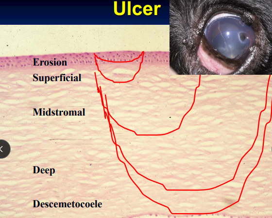 <ul><li><p><span style="background-color: transparent;"><strong><span>Cs:</span></strong><span> </span></span><span style="background-color: transparent; color: red;"><strong><u><span>Extreme pain</span></u></strong></span><span style="background-color: transparent;"><strong><u><span>,</span></u></strong><span> focal edema</span></span></p></li></ul><ul><li><p><strong>CN 5 trigeminal nerve supplies outer 1/3 of cornea</strong> </p></li></ul><ul><li><p><strong>EXAM #1</strong>: Look for eyelid abnormalities, <strong>location/size of ulcer, FB, hair, infectious causes </strong></p></li><li><p><span style="background-color: transparent;"><strong><span>Tx: </span></strong></span><span style="background-color: transparent; color: red;"><strong><u><span>Heal within 48-72 hours</span></u></strong></span><span style="background-color: transparent;"><span> if cause removed</span></span></p><ul><li><p><span style="background-color: transparent;"><strong><span>If not healed after 5 days:</span></strong><span> cause persists, infection present, </span></span><span style="background-color: transparent; color: red;"><span>indolent ulcer</span></span><span style="background-color: transparent;"><span> present, FHV-1</span></span></p></li></ul></li></ul><p></p>