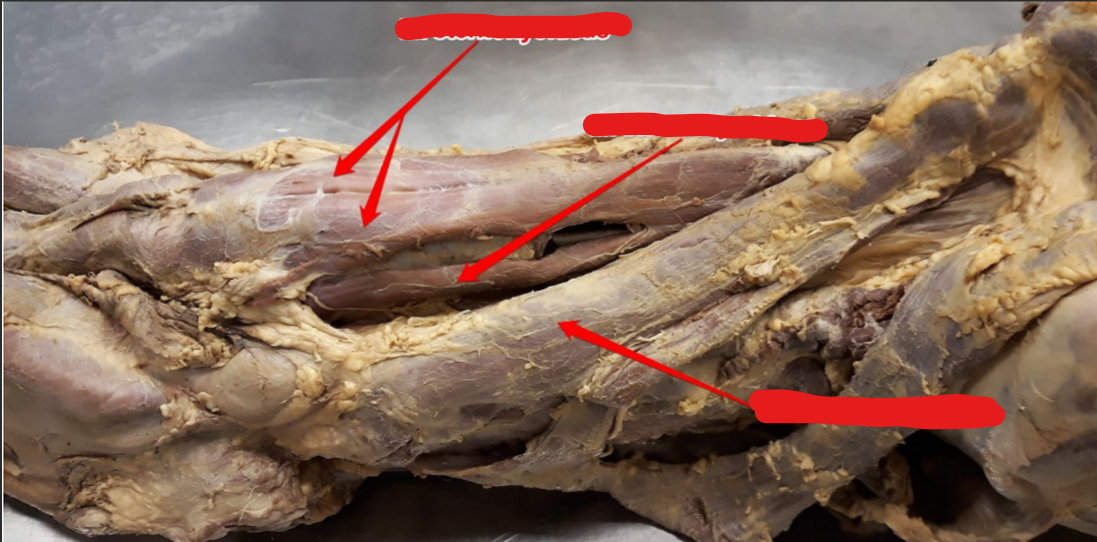 <p>Övre pilar, O, I</p>